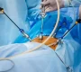Los Beneficios de la Cirugia Laparoscopica 90x80